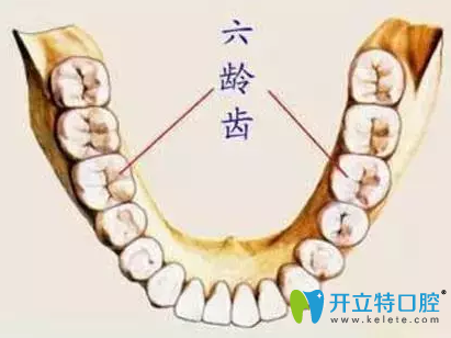 石家庄三博口腔六龄齿示意图