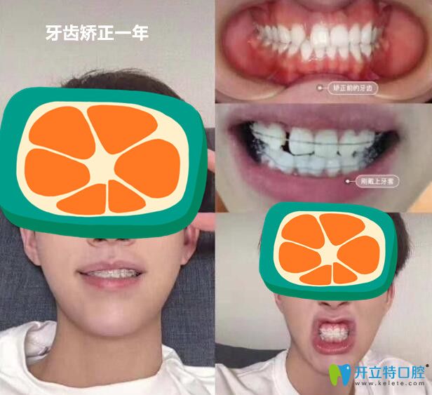 ݽǰͱ仯ͼԱЧ