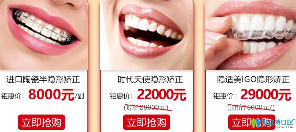 无套路来广州牙科能0元试戴隐形牙套矫正价格还能减1千