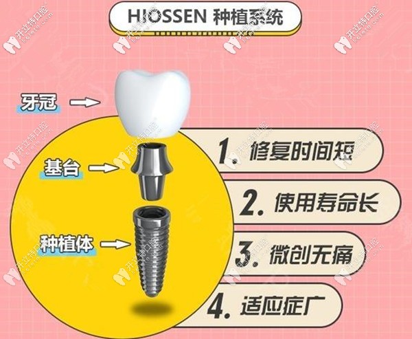 5,美国百康种植系统10800元起/颗