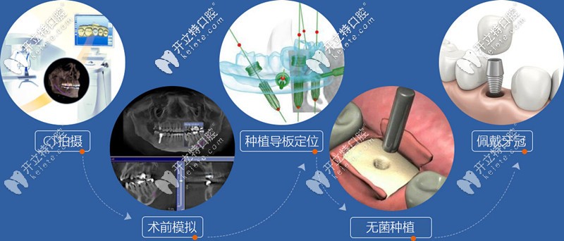 撸到上海正规医院韩国全口种植牙价格表,缺牙者机不可