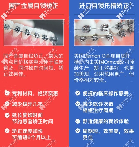 广州市牙套价格表请收藏,金属自锁 隐形矫正的费用值得一观