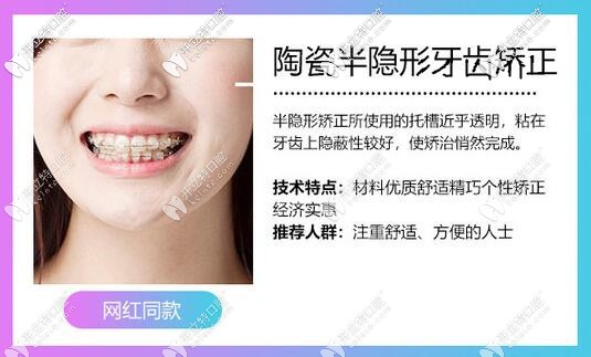 你想要的深圳金属 隐形牙齿矫正价格表,钢牙套3980就能拿下