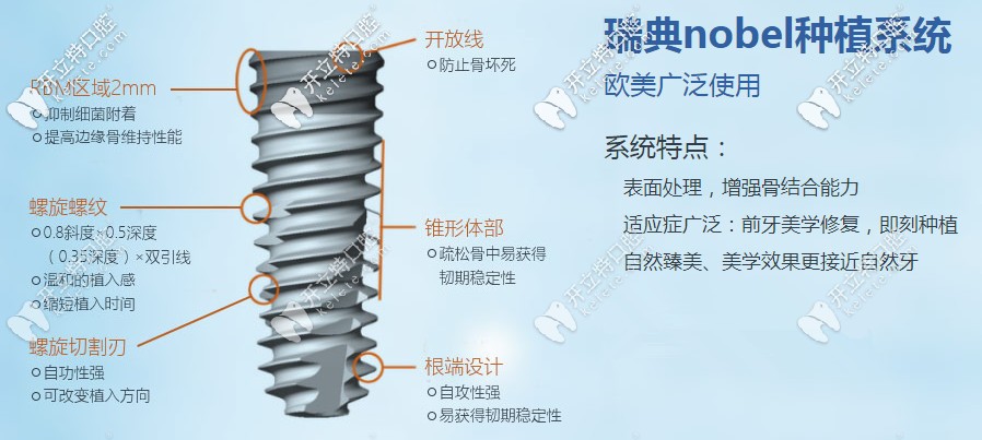 解锁618上海摩尔齿科价格表,瑞典诺贝尔pcc种植体划算