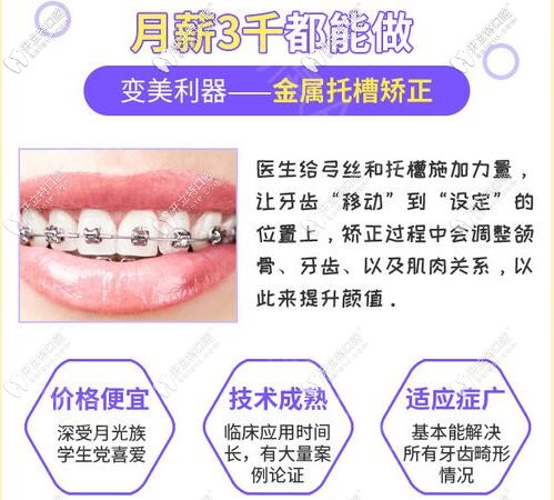 深圳美奥暑期正畸普通固定矫正和活动隐形牙套价格更新
