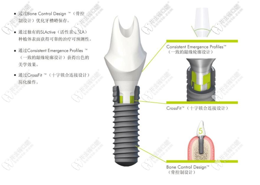 瑞士iti种植体型号中的nc和rc区别是都是士卓曼骨水平植体吗