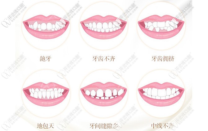 公开宜昌牙科医院的收费标准,含整牙/拔智齿/种植牙价格