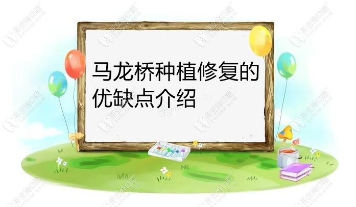 为了研究马龙桥种植修复是什么,我把优缺点和原理都搞懂了