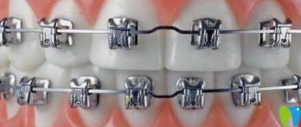 一个牙医的良心忠告：确定看牙医前先明白这10点