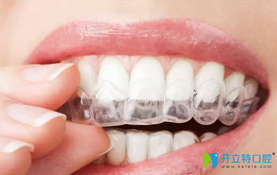 济宁口腔为你解答：成年人能进行牙齿矫正吗？