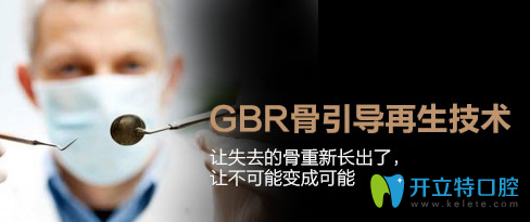 GBR骨引导再生术