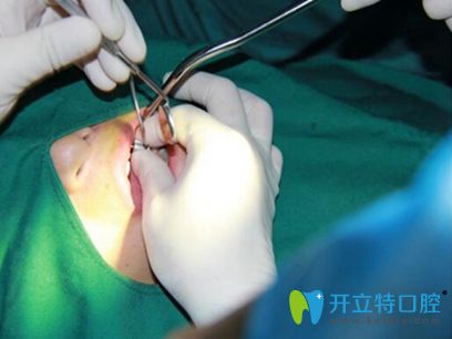 合肥佳德口腔牙齿种植案例 合肥佳德口腔牙齿种植案例