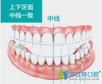 牙齿修复标准
