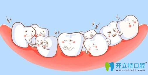 阜阳贝得口腔做成人牙齿矫正和儿童牙齿矫正有什么不同？