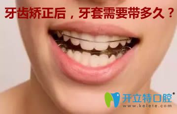 牙齿矫正后牙套需要带多久