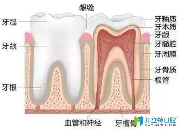 牙齿根管治疗的介绍