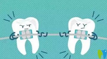 牙齿矫正后佩戴保持器图示 牙齿矫正后佩戴保持器图示