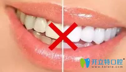 洗牙和牙齿美白是有区别的