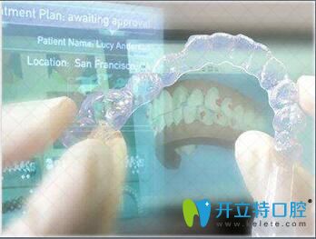 乌鲁木齐美奥口腔门诊数字化矫正系统优势 乌鲁木齐美奥口腔门诊数字化矫正系统优势