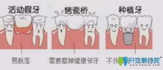 郴州芙蓉口腔牙齿种植案例 让你拥有属于自己的“真牙”