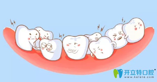 白山欣美口腔诊所告诉你牙齿矫正6大误区，你中了几条?