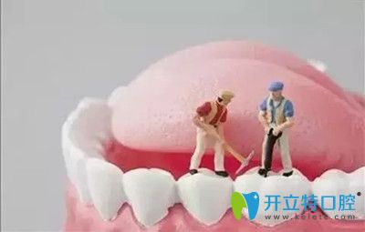 种植牙的寿命维持更长时间的小窍门