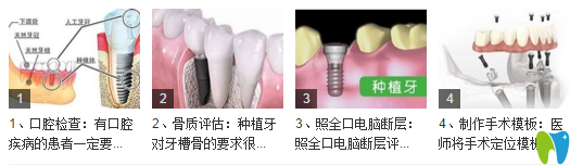 种植牙的手术过程
