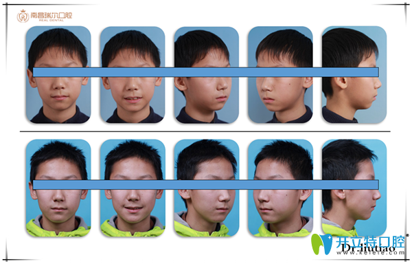 拥挤，单纯排齐