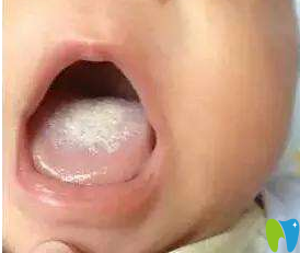 张家口恩瑞齿科解析孩子易患的口腔疾病有哪些？