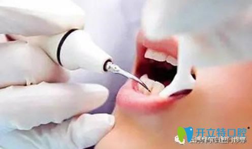 云浮拜尔口腔微创无痛拔牙技术