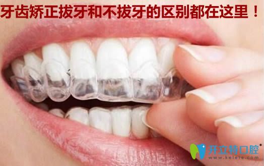 牙齿矫正拔牙和不拔牙的区别?看辽阳嘉和口腔的医生如何说