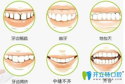 广州优典口腔侯振杰院长解析牙齿矫正的危害