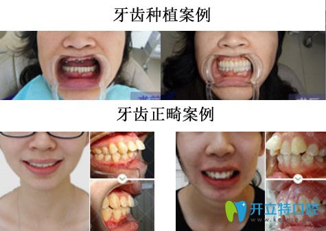 20180717835890.jpg yiren_副本.jpg