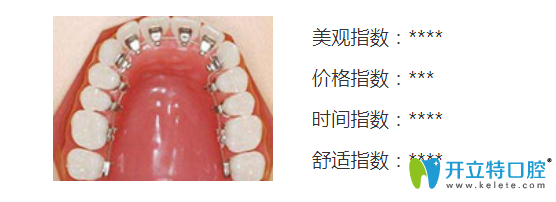 北京康贝佳口腔舌侧隐形矫正技术