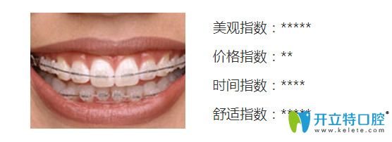 使用康贝佳口腔陶瓷半隐形托槽矫正优惠 使用康贝佳口腔陶瓷半隐形托槽矫正优惠
