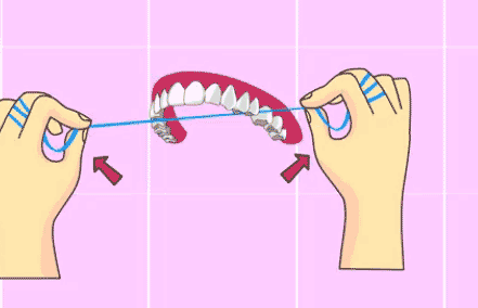 牙线使用方法二将牙线上下滑动着进入牙缝