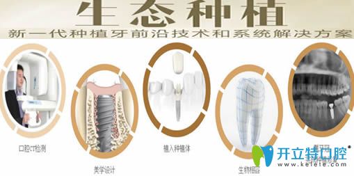成都唐牙科生态种植牙分解图 成都唐牙科生态种植牙分解图