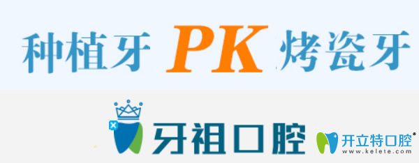烤瓷牙和种植牙哪个好 烤瓷牙和种植牙哪个好