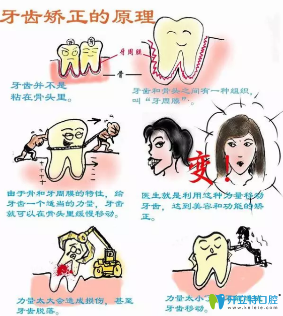 了解牙齿正畸原理后就知道正畸导致牙齿松是真是假