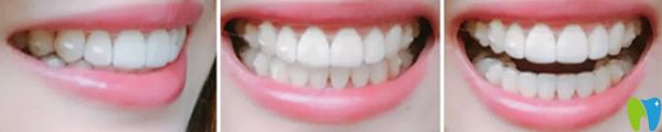 康祖铭正畸<span style= 康祖铭正畸<span style=