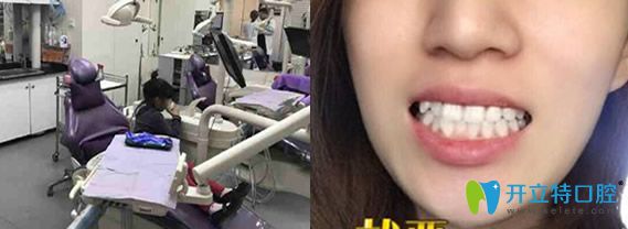 洁牙后顾客评价北京今生口腔 洁牙后顾客评价北京今生口腔