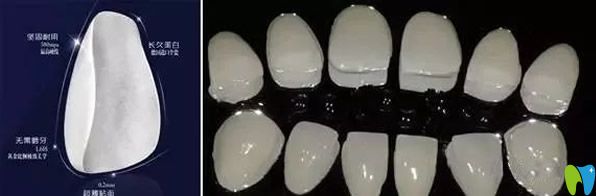 全瓷贴面修复后的牙齿可与真牙相媲美