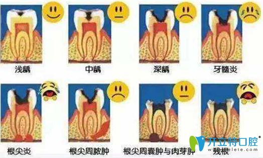 牙齿神经痛发展过程图