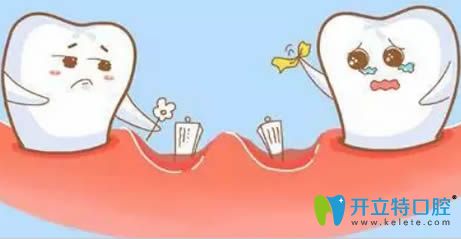 青岛天皓口腔诊所牙齿缺失动画图