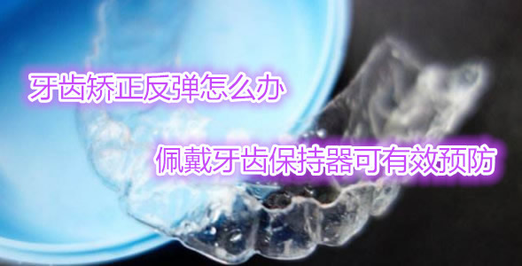 牙齿矫正一定要佩戴牙齿保持器吗