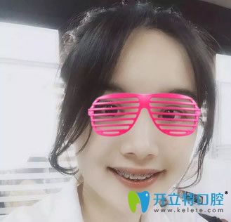 华尔康口腔带牙套1~12月的变化图 华尔康口腔带牙套1~12月的变化图