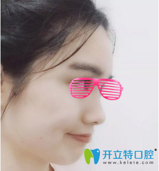 矫正牙齿12个月<span style= 矫正牙齿12个月<span style=