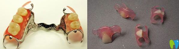 四环素牙怎么办 无锡博奥口腔张院长公布美白牙齿修复方法
