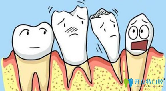 牙龈萎缩的原因有哪些