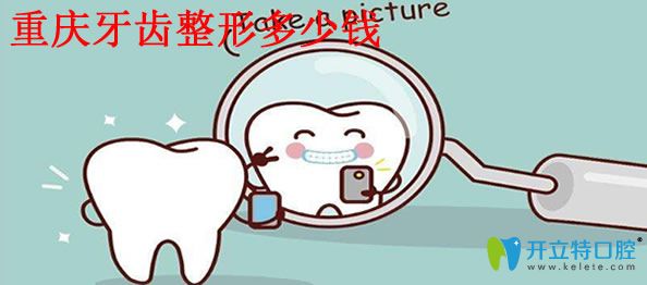 重庆牙齿整形多少钱